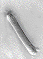 http://www.yaleearlab.org/intranet/images/ohc.gif